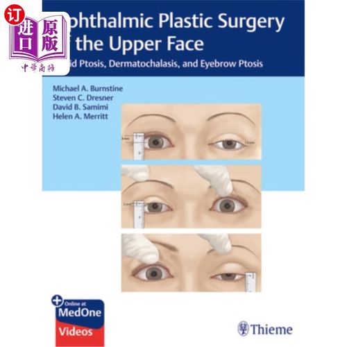 eyelid surgery post op pictures,Understanding the Eyelid Surgery Post-Op Pictures