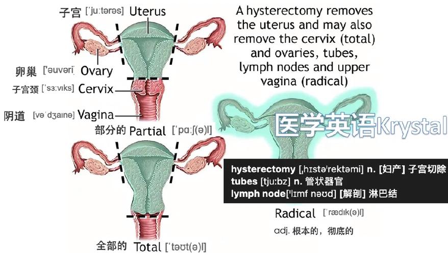 hysterectomy 2 weeks post op,Hysterectomy 2 Weeks Post Op: A Comprehensive Guide