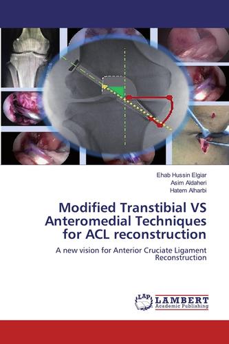 acl reconstruction post op,Acl Reconstruction Post Op: A Comprehensive Guide